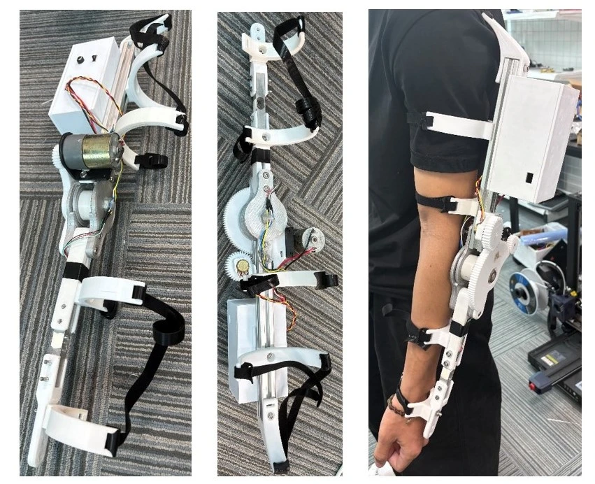 Cánh tay robot hỗ trợ vận động cho người bại não
